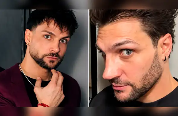 Nicola Porcella nueva nariz wapa.pe