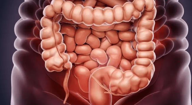 <em>El cáncer de colon: una amenaza silenciosa que ya ocupa uno de los primeros lugares en diagnósticos oncológicos en Perú </em> <em>El cáncer de colon: una amenaza silenciosa que ya ocupa uno de los primeros lugares en diagnósticos oncológicos en Perú </em>