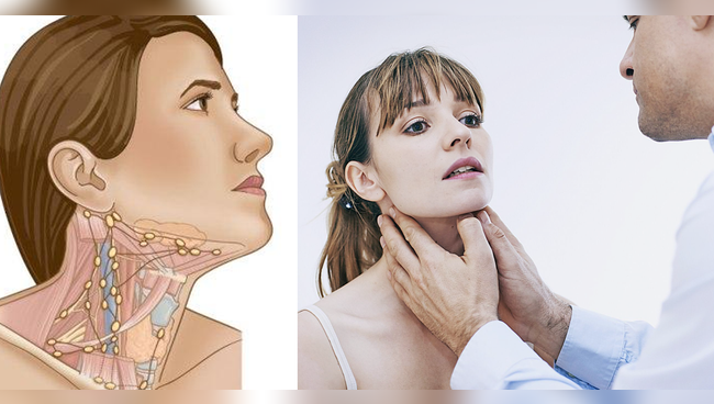 Ganglios linfáticos: ¿Qué es ese bulto que está en el cuello?