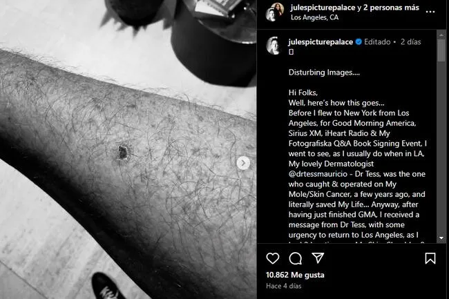 Julian Lennon y su mensaje tras ser detectado de cáncer de piel por segunda vez.   