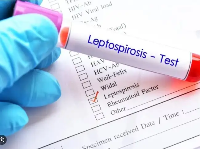 Cómo prevenir la leptospirosis. Cómo prevenir la leptospirosis.