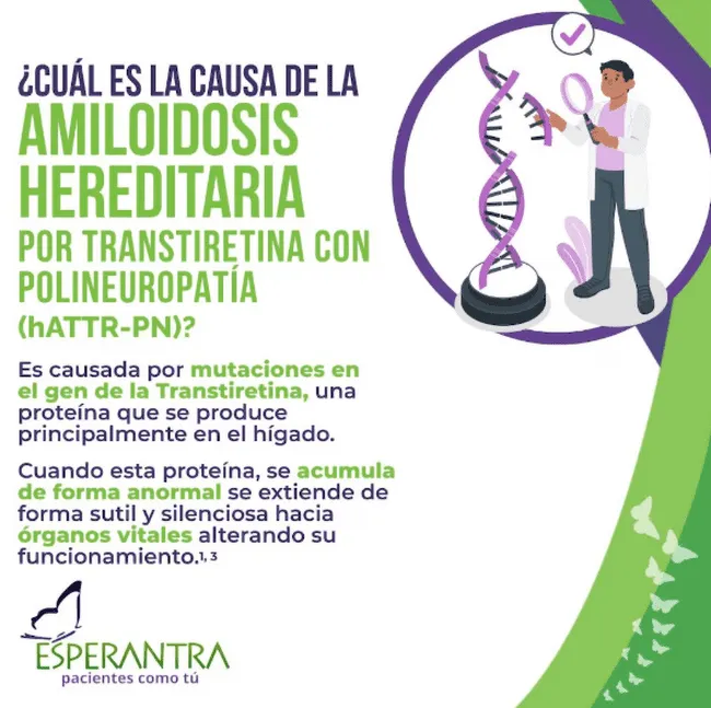 <strong>Amiloidosis Hereditaria</strong> <strong>Amiloidosis Hereditaria</strong>