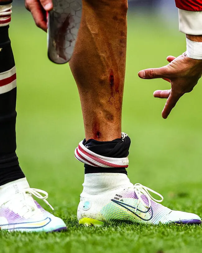 Herida de Cristiano Ronaldo durante el partido entre Manchester United y Everton.   